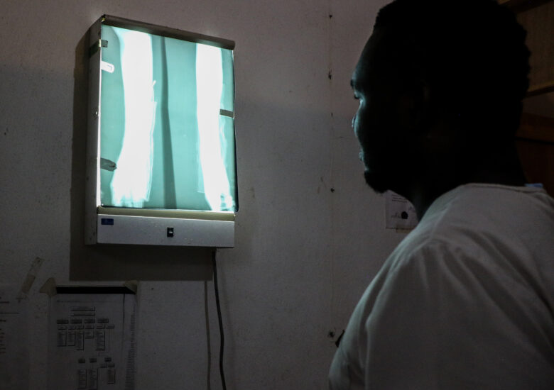 Dr. Judelin examining an X-ray of a patients broken arm, at the clinic Sante 2000 in Haut Limbe, Haiti.